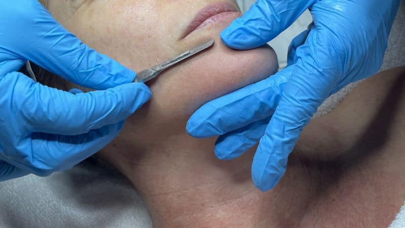 Achieve Smoother and More Vibrant Skin with a Dermaplaning Treatment